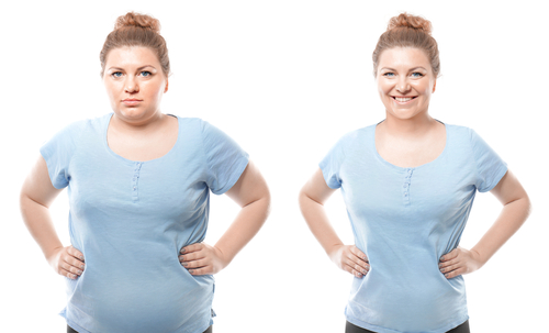 Young,Woman,Before,And,After,Weight,Loss,On,White,Background.